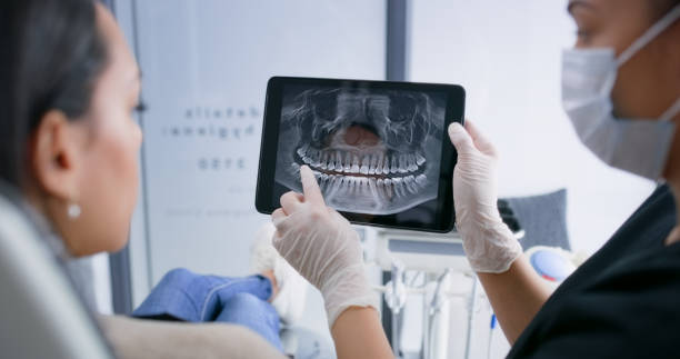 Licensed Tooth Extraction service in Laguna Woods, CA - Smile Center Dentistry